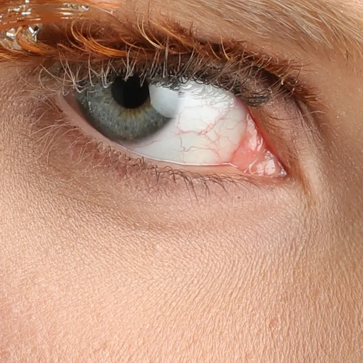 샘플 사진 크롭